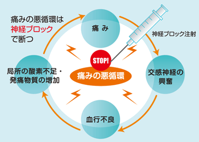 痛みの悪循環
